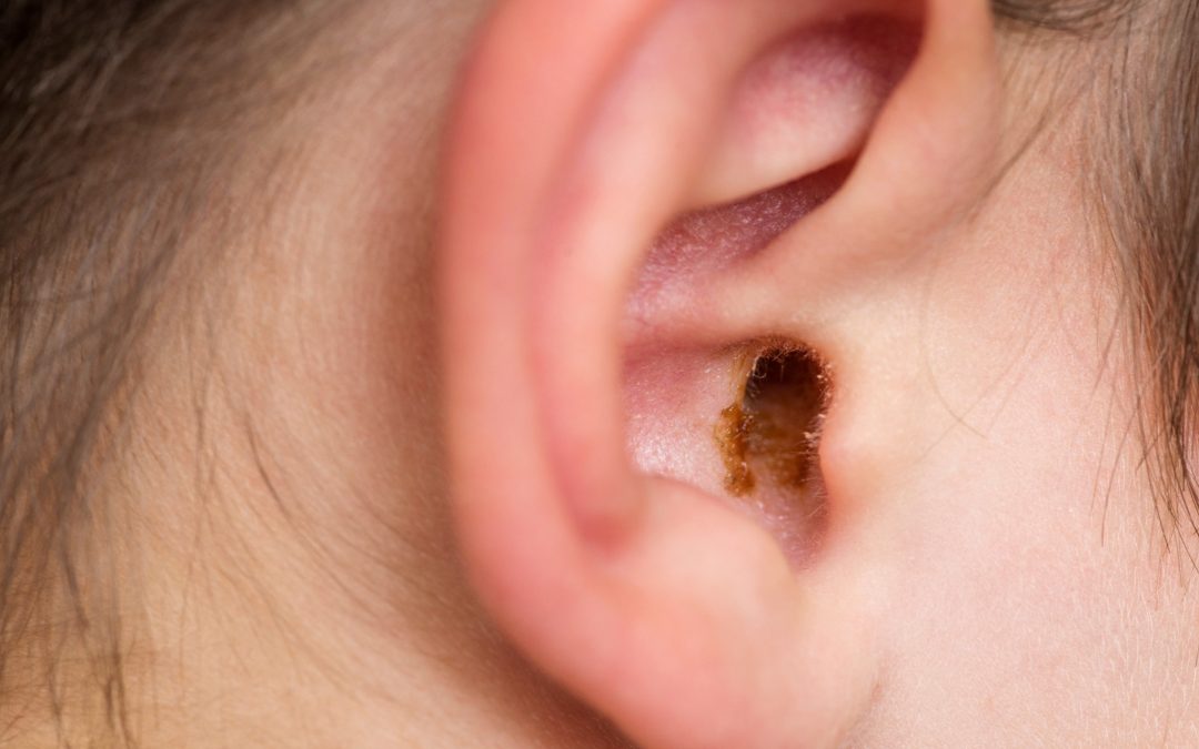 Six Crazy Details You Should Learn About Earwax